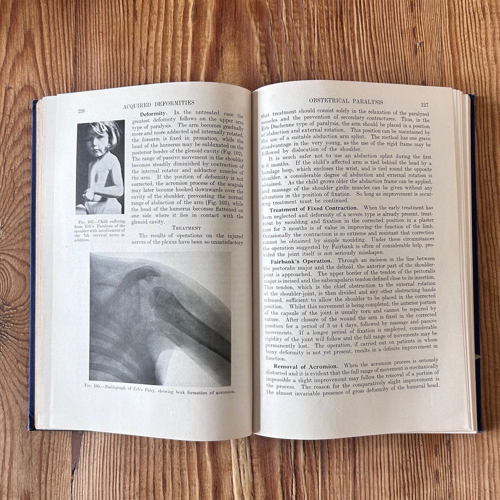 A Practice of Orthopaedic Surgery by T P McMurray c1949 - Image 3