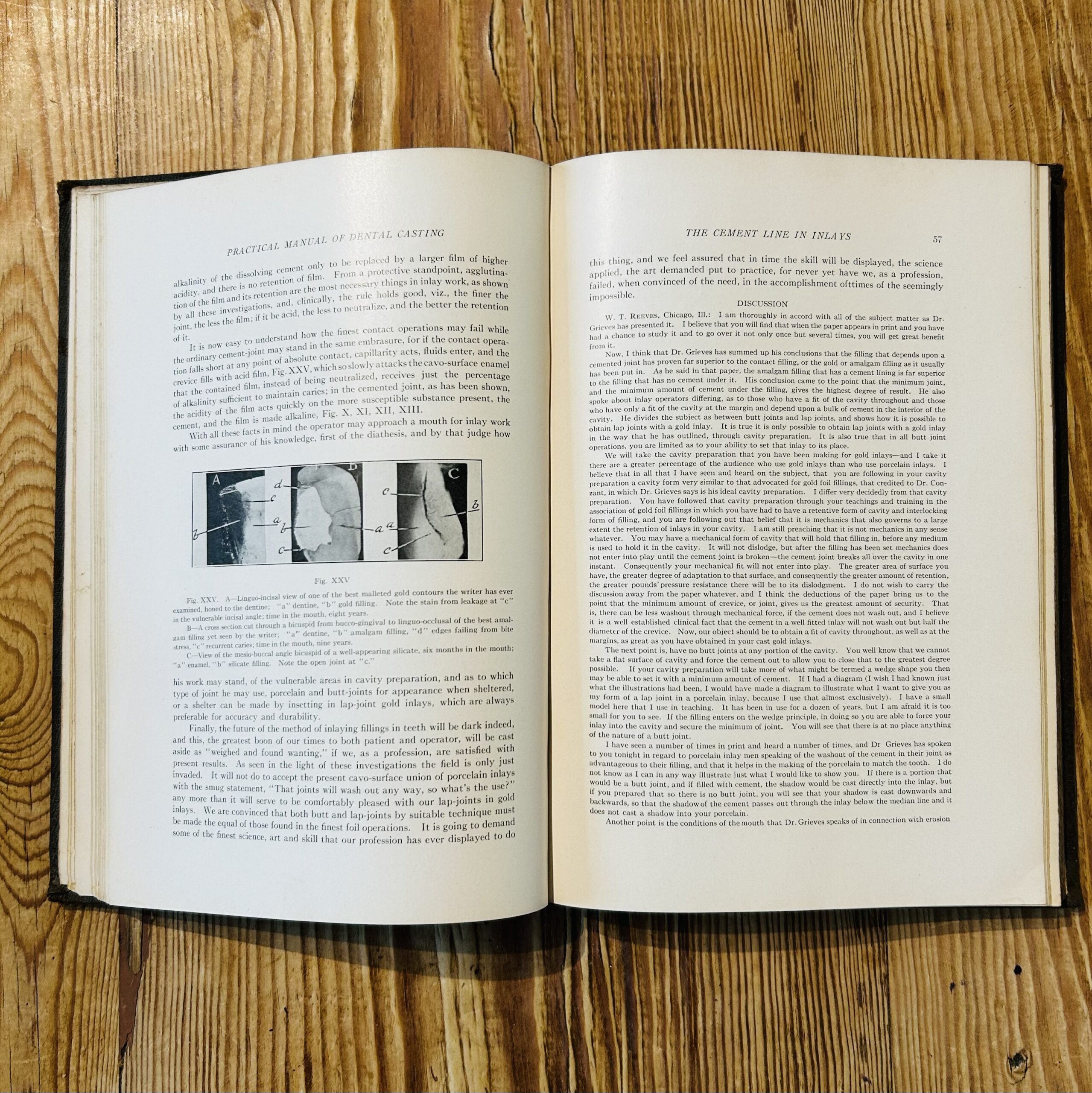 The Practical Manual of Dental Casting by Various Authors c1941 - Image 4