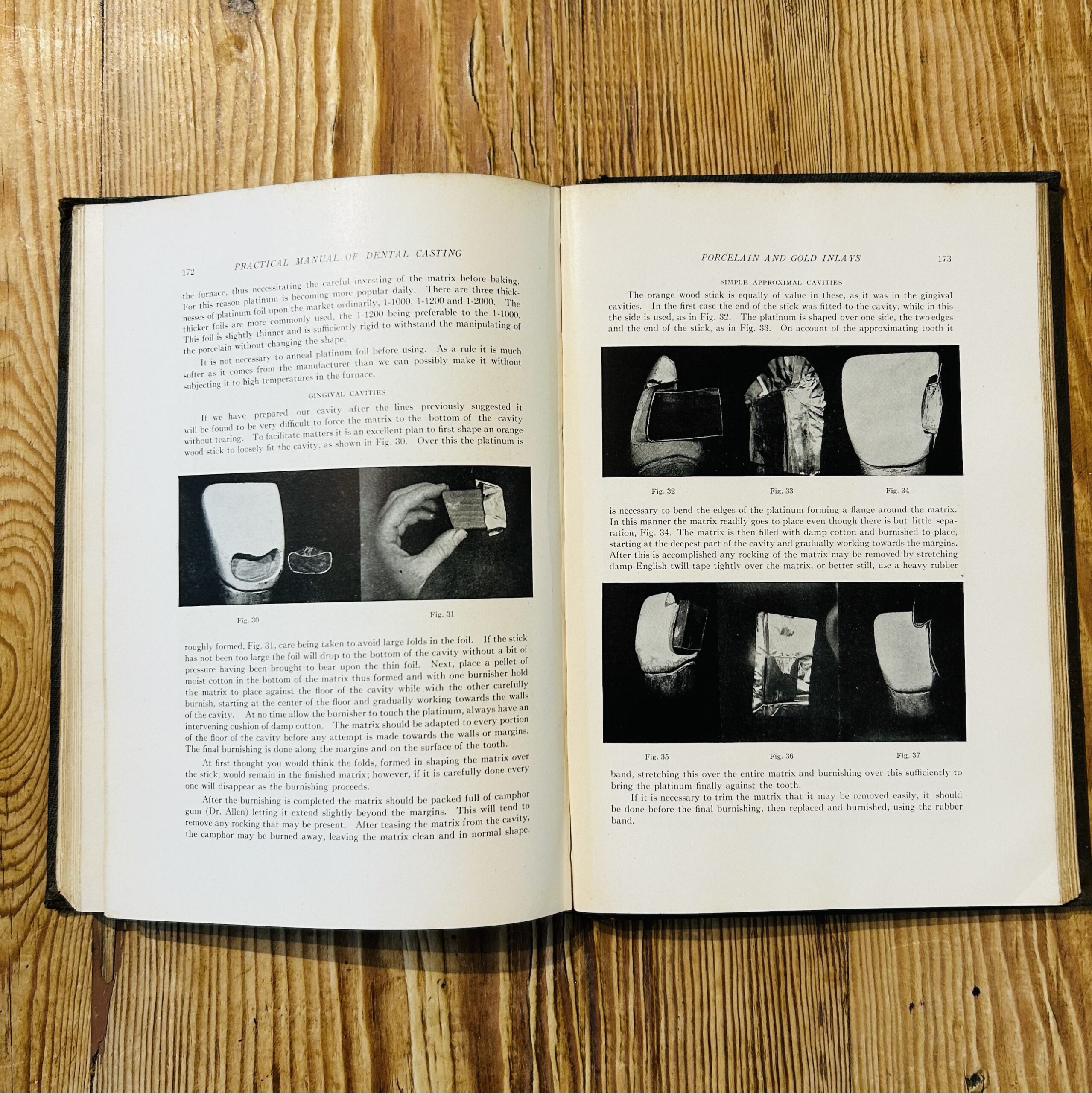 The Practical Manual of Dental Casting by Various Authors c1941 - Image 3